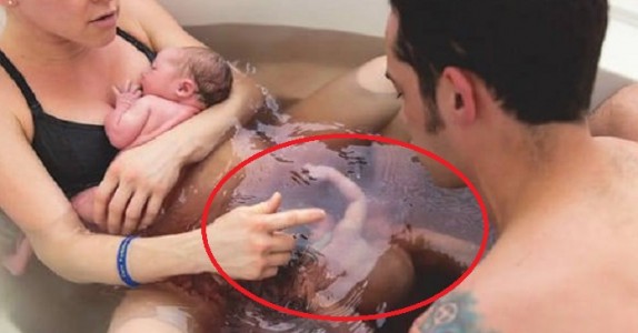 Mamma och pappa förväntar sig normala tvillingar, men när de ser barn nummer två? Otroligt …