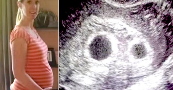 Mamman är gravid med tvillingar. Men 25 veckor senare berättar läkarna något CHOCKERANDE!