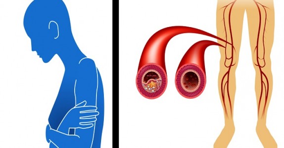 8 tecken och symptom på att du har dålig cirkulation och kanske något ännu värre utan att veta om det!