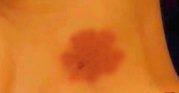 Flickvän ger 17-åring ett sugmärke – dagar senare hittar föräldrarna honom död!