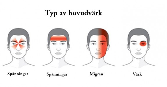 Hur din huvudvärk kan avslöja vad som är fel med din hälsa!