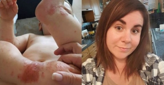 Hon lät hennes vän kyssa hennes baby, dagar senare fick hon en mammas värsta mardröm!