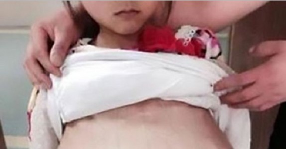Läkare ser att 12-åringen är GRAVID! Sedan får de veta vem fadern är! USCH!