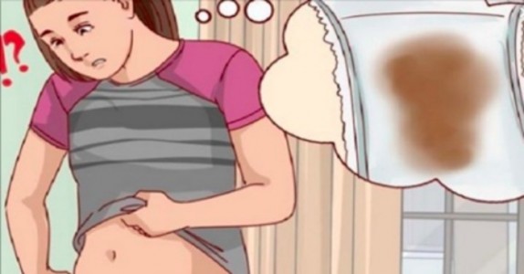 Gynekologer VARNAR! Ignorera aldrig dessa 6 menstruella problemen!