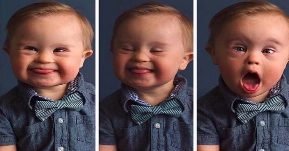 Modellagenturen vägrade ta emot pojken med Downs syndrom! Moderns svar HYLLAS!