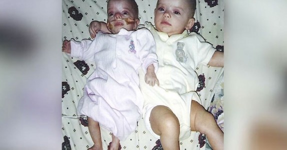 Mamman vet inte hon skulle få tvillingar fram tills hon var 6 månader gravid! Då upptäcker läkarna det HÄR!
