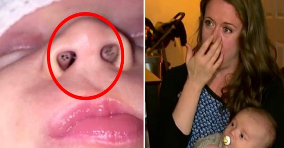 Mamman upptäcker mystiska fläckar i barnets näsa – nu vill hon dela den fruktansvärda orsaken!